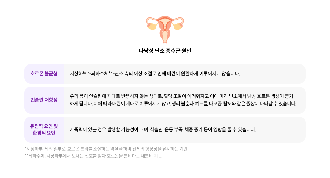 다낭성 난소 증후군 원인