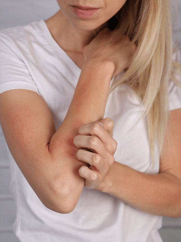 목숨을 위협하는 “아나필락시스” 