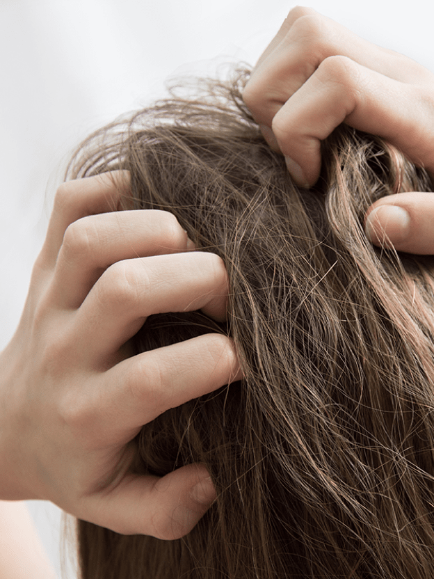 이 머리 뭐야! 너 두피에 문제 있어?