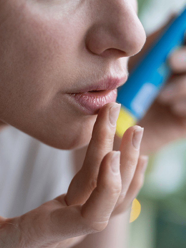 사계절 변함없이 성한 날이 없는 내 입술 어쩌지?