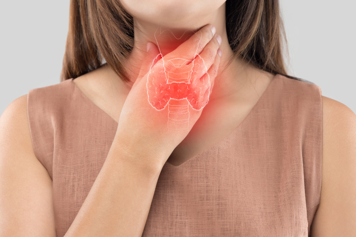 이유 없이 갑자기 찐 살…혹시…?